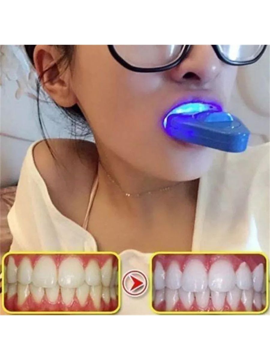 Аппарат для отбеливания зубов